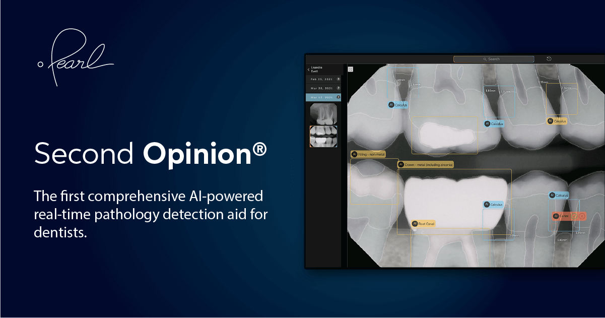 Pearl Second Opinion®